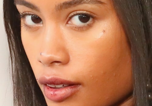 Does Cheek Filling Get Worse Under the Eyes?