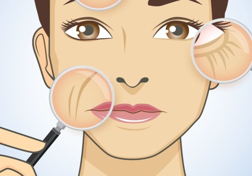 Everything You Need to Know About Dermal Fillers in the UK